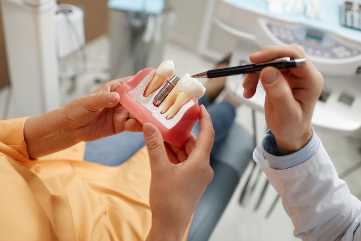 Benefits dental implants in arlington